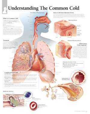 The Common Cold Chart: Laminated Wall Chart de various