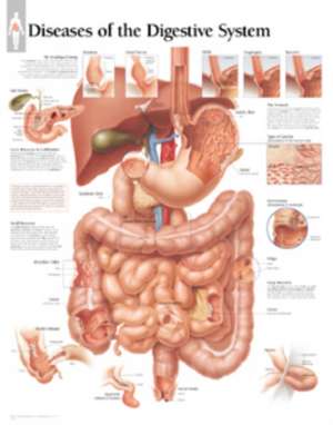 Diseases of Digestive System Chart: Laminated Wall Chart de Scientific Publishing