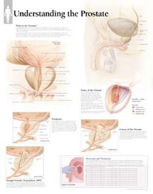 Understanding the Prostate: Wall Chart de Scientific Publishing