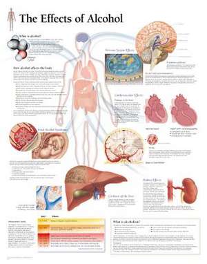 The Effects of Alcohol Chart: Wall Chart de various