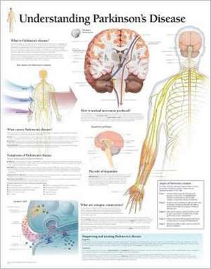 Understanding Parkinson's Paper Poster de Scientific Publishing