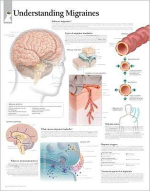 Understanding Migraines Chart: Laminated Wall Chart de various