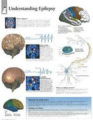 Understanding Epilepsy Chart: Wall Chart de various