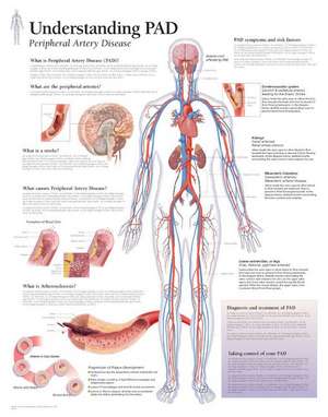 Understanding PAD Laminated Poster de Scientific Publishing