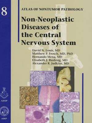 Non-Neoplastic Diseases of the Central Nervous System de MD Louis, David N.