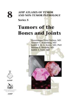 Tumors of the Bones and Joints de G. Petur Nielsen