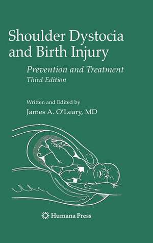 Shoulder Dystocia and Birth Injury: Prevention and Treatment de James A. O'Leary