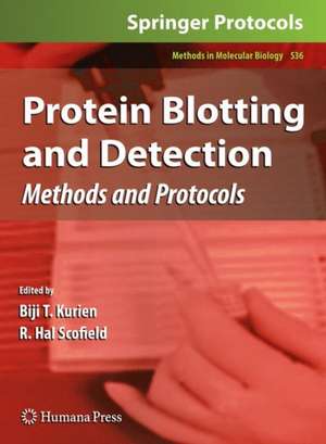 Protein Blotting and Detection: Methods and Protocols de Biji T. Kurien