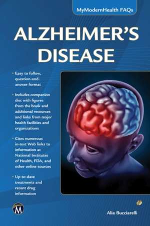 Alzheimer's Disease: My Modern Health FAQs de Norman Poole