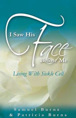 I Saw His Face Before Me - Living with Sickle Cell Anemia de Samuel a. Burns