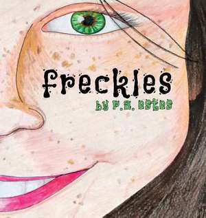 Freckles de Ruth Estes