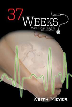 37 Weeks de Keith Meyer