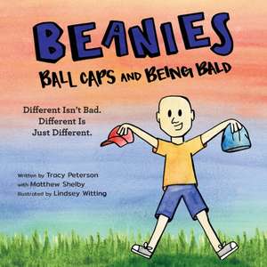 Beanies, Ball Caps, and Being Bald de Tracy Peterson