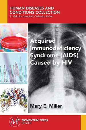 Acquired Immunodeficiency Syndrome (AIDS) Caused by HIV de Mary E. Miller