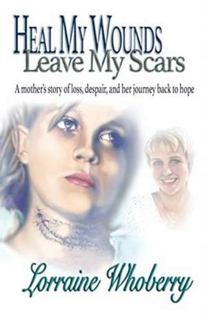 Heal My Wounds, Leave My Scars de Lorraine Reed Whoberry