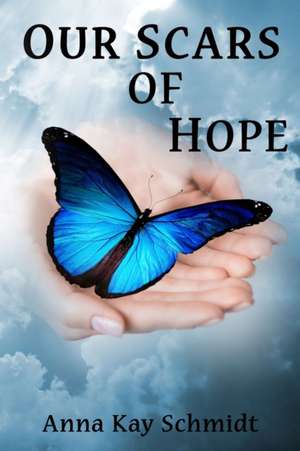 Our Scars of Hope de Anna Kay Schmidt