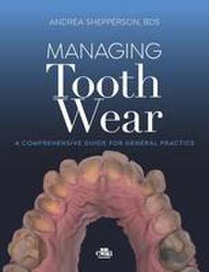 Managing Tooth Wear de Andrea Shepperson