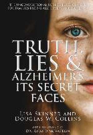 Truth, Lies & Alzheimer's de Douglas W Collins