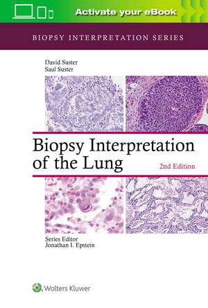 Biopsy Interpretation of the Lung de Saul Suster MD