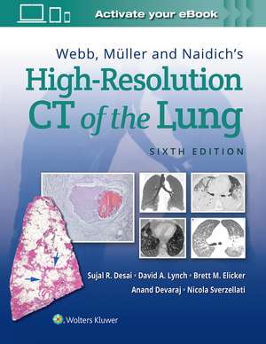 Webb, Müller and Naidich's High-Resolution CT of the Lung de Sujal Desai