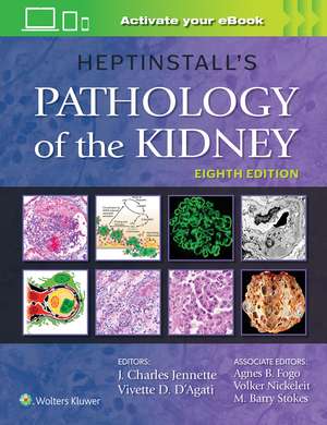 Heptinstall's Pathology of the Kidney de J. Charles Jennette MD