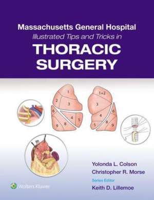 Massachusetts General Hospital Illustrated Tips and Tricks in Thoracic Surgery: Print + eBook with Multimedia de Yolonda Colson