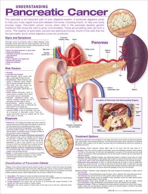 Understanding Pancreatic Cancer Anatomical Chart de Anatomical Chart Company