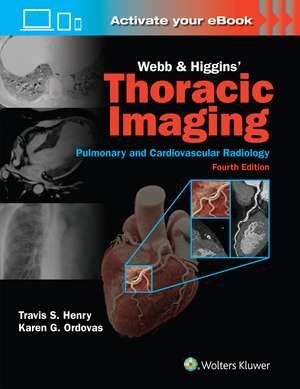 Webb & Higgins Thoracic Imaging: Print + eBook with Multimedia de Travis Henry MD