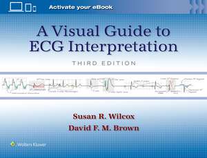 A Visual Guide to ECG Interpretation: Print + eBook with Multimedia de Susan Renee Wilcox