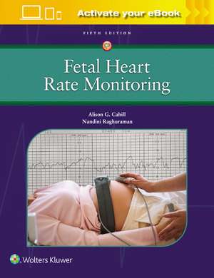 Fetal Heart Rate Monitoring de Alison Cahill