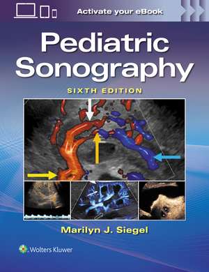 Pediatric Sonography de MARILYN JOY SIEGEL