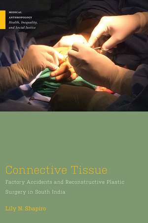 Connective Tissue de Lily N Shapiro