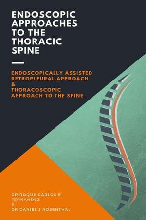 Endoscopic Approaches to the Thoracic Spine de Fernandez, Dr Roque Carlos E.