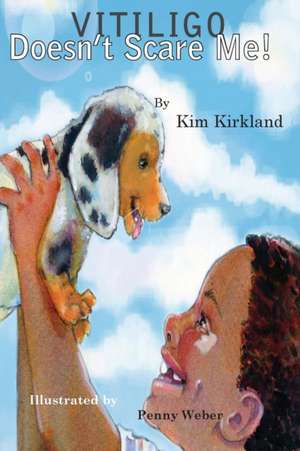 Vitiligo Doesn't Scare Me de Kim Kirkland