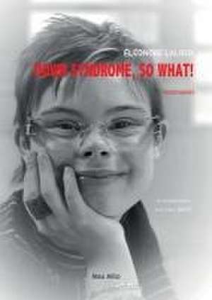 Down Syndrome, So What! de Eléonore Laloux