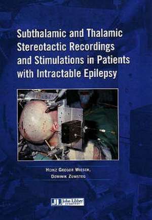 Subthalamic and Thalamic Stereotactic Recordings and Stimulations in Patients with Intractable Epilepsy de H.G. WIESER