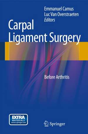 Carpal Ligament Surgery: Before Arthritis de Emmanuel Camus