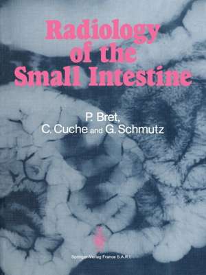 Radiology of the small intestine de Pierre Bret