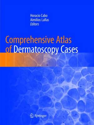 Comprehensive Atlas of Dermatoscopy Cases de Horacio Cabo