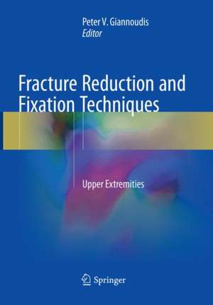 Fracture Reduction and Fixation Techniques: Upper Extremities de Peter V. Giannoudis