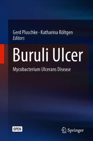 Buruli Ulcer: Mycobacterium Ulcerans Disease de Gerd Pluschke