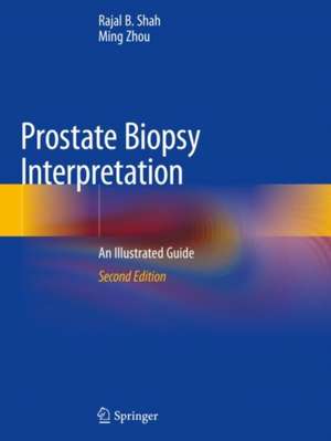 Prostate Biopsy Interpretation: An Illustrated Guide de Rajal B. Shah