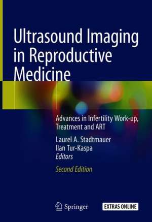 Ultrasound Imaging in Reproductive Medicine: Advances in Infertility Work-up, Treatment and ART de Laurel A. Stadtmauer