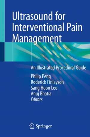 Ultrasound for Interventional Pain Management: An Illustrated Procedural Guide de Philip Peng