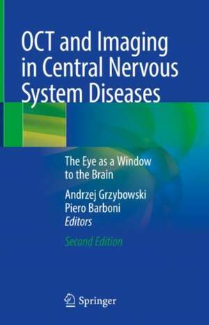 OCT and Imaging in Central Nervous System Diseases: The Eye as a Window to the Brain de Andrzej Grzybowski