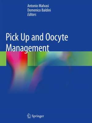 Pick Up and Oocyte Management de Antonio Malvasi