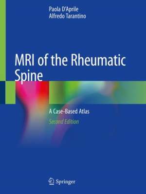 MRI of the Rheumatic Spine: A Case-Based Atlas de Paola D'Aprile