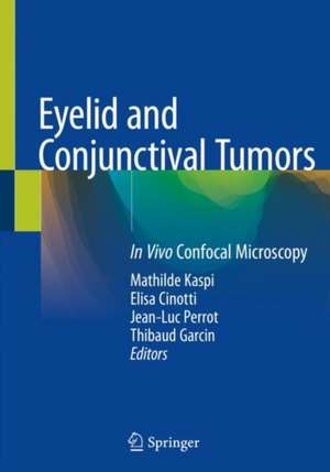 Eyelid and Conjunctival Tumors: In Vivo Confocal Microscopy de Mathilde Kaspi