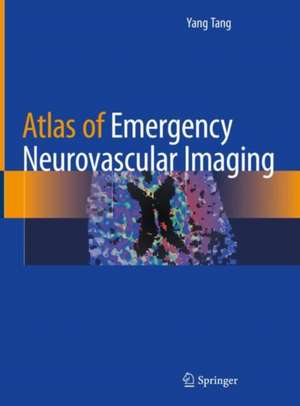 Atlas of Emergency Neurovascular Imaging de Yang Tang