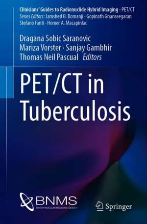 PET/CT in Tuberculosis de Dragana Sobic Saranovic